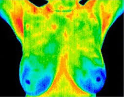 Keep your Breasts Beautiful Through Thermographic Imaging imgres 4